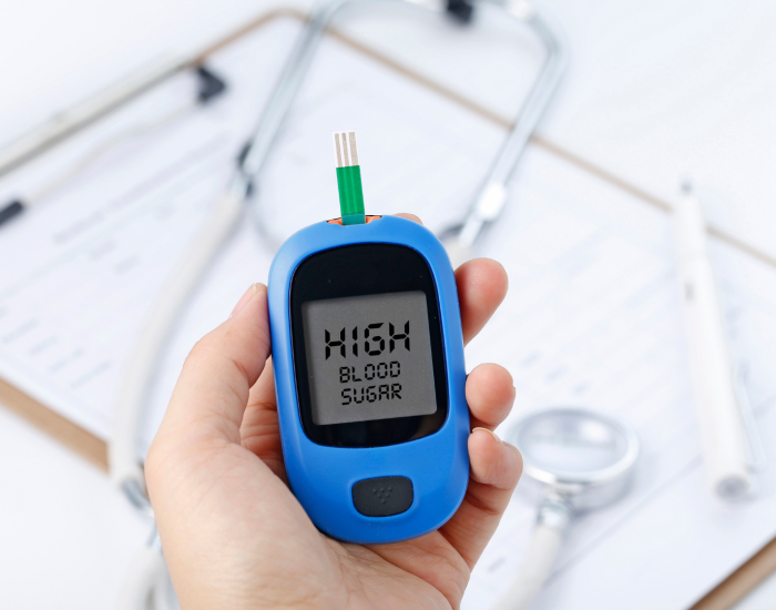High Glucose in Blood: Causes, Symptoms, Effects, Treatment & Prevention