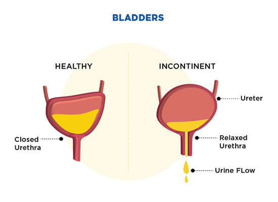 bladders